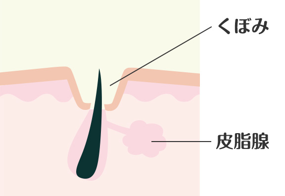 クレーター仕組み