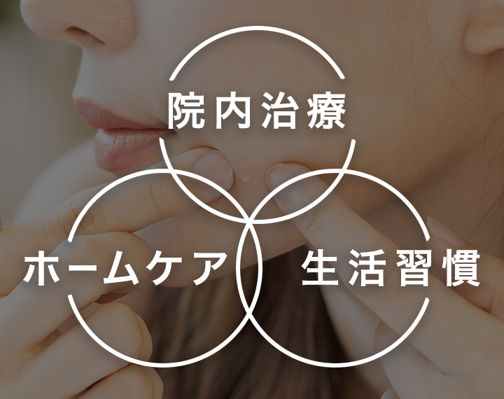 フェミー式ニキビ治療とは?