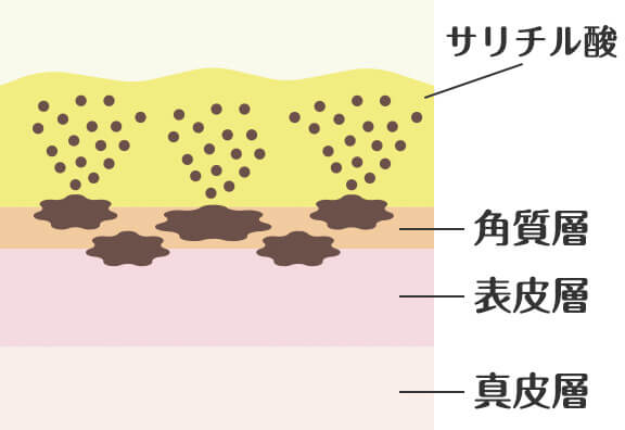 サリチル酸マクロゴール