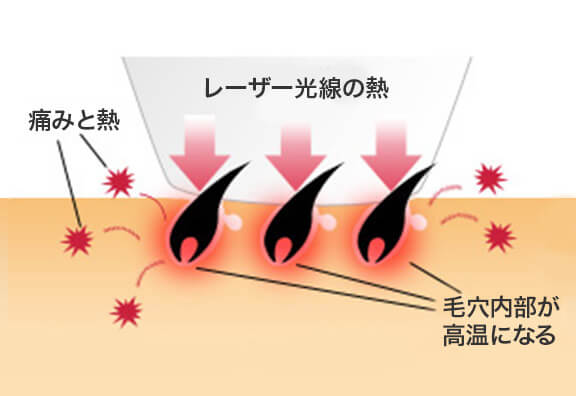 火傷のリスクや痛みを強く感じるため