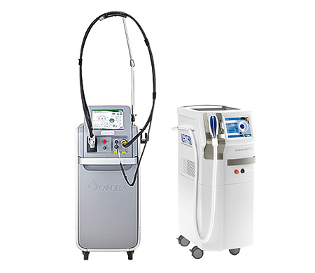 医療レーザー脱毛機器5種類