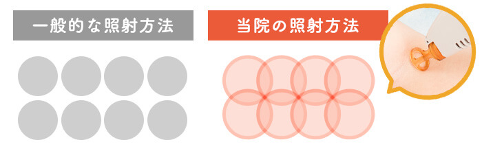 池袋フェミークリニックの照射漏れ対策