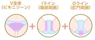 ハイジニーナ脱毛の範囲