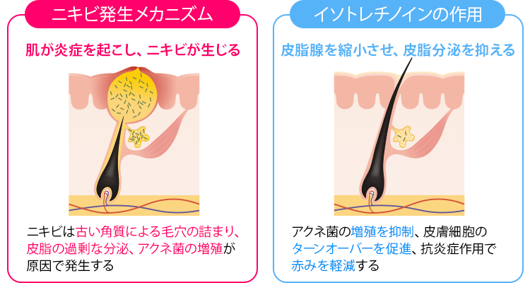 イソトロインの仕組み