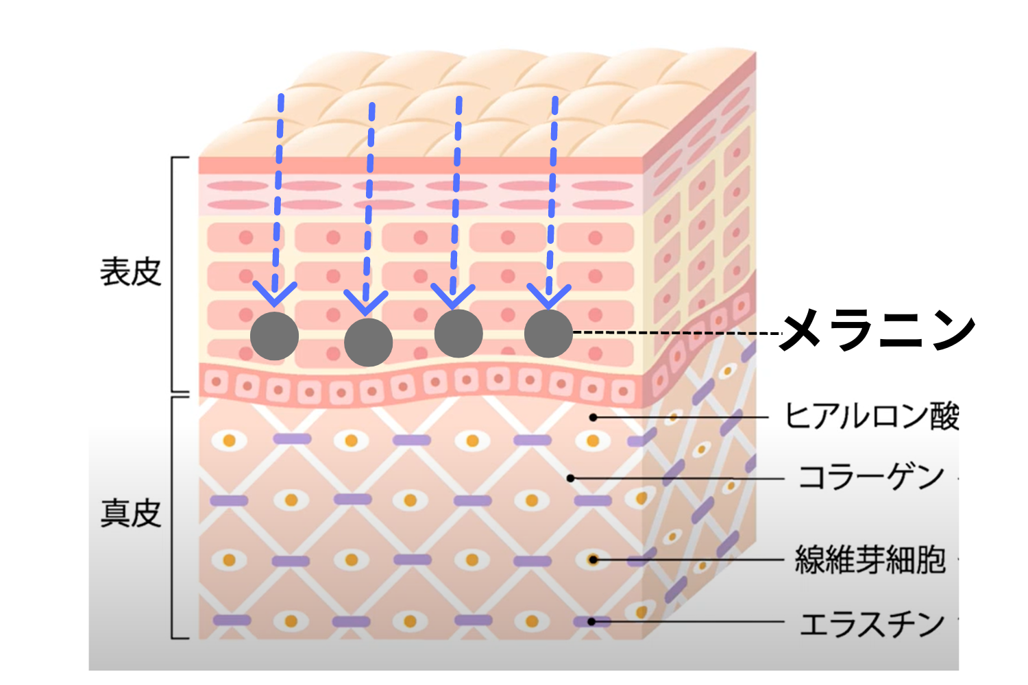 シミやくすみの治療方法とは?