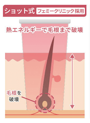 熱破壊式（ショット式）