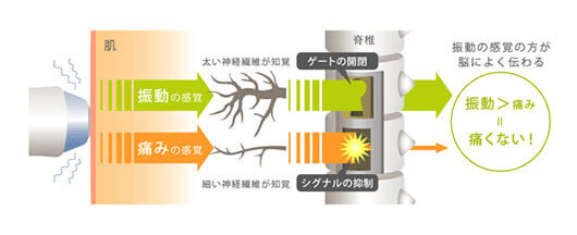 様々第三世代サーマクールCPTの特徴