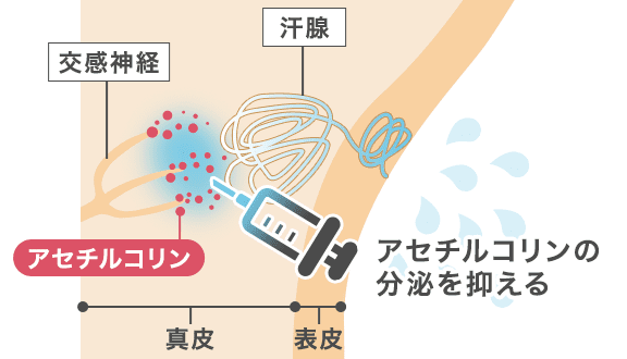 ワキボトックスの仕組み