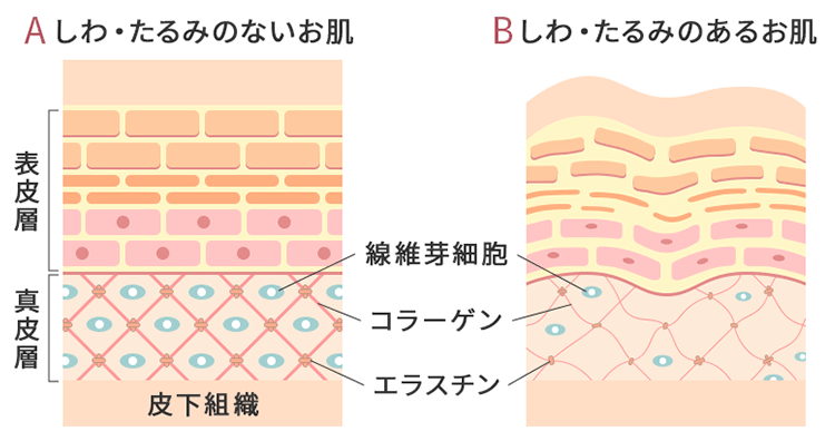 しわ・たるみの原因