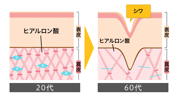 リジュランとは？