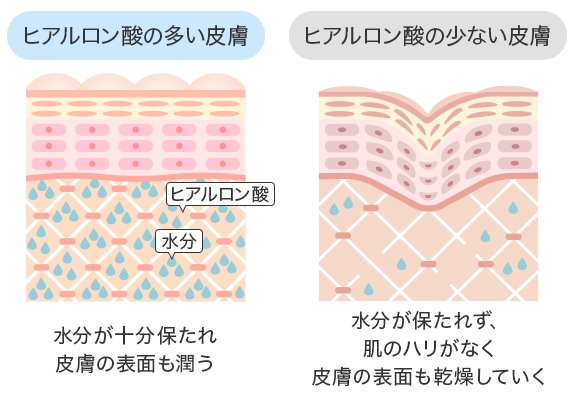 ヒアルロン酸の少ない肌