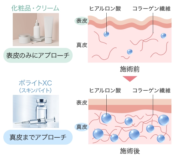 化粧品との保湿効果の違い