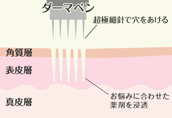 仕組み